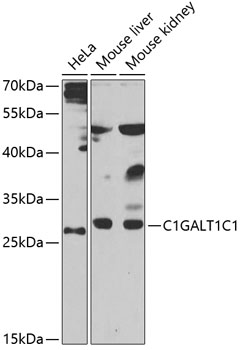 C1GALT1C1 Rabbit Polyclonal Antibody