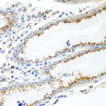 UBIAD1 Rabbit Polyclonal Antibody