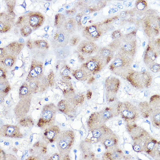 BAAT Rabbit Polyclonal Antibody