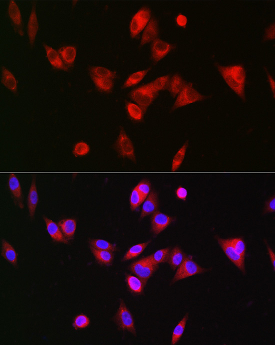 BAAT Rabbit Polyclonal Antibody
