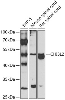CHI3L2 Rabbit Polyclonal Antibody