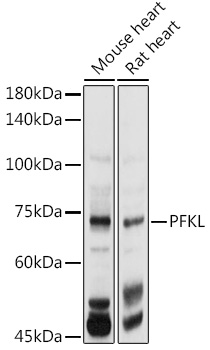 PFKL Rabbit Polyclonal Antibody