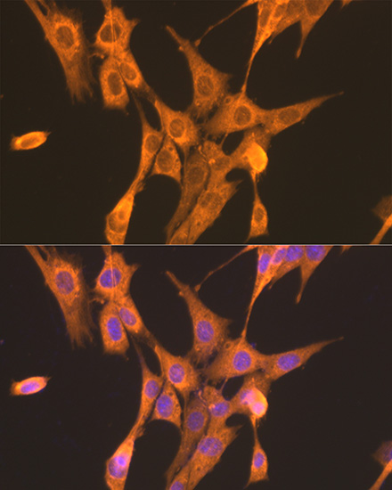 PFKL Rabbit Polyclonal Antibody