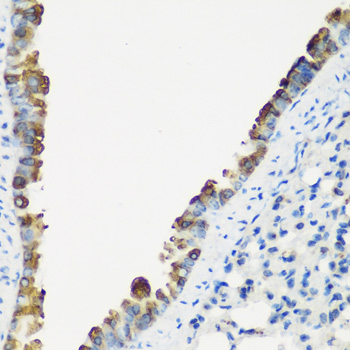 TNNC2 Rabbit Polyclonal Antibody