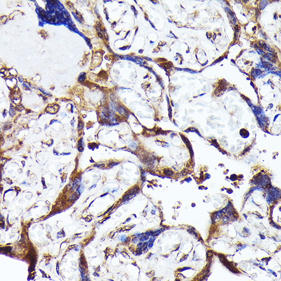 MTMR4 Rabbit Polyclonal Antibody