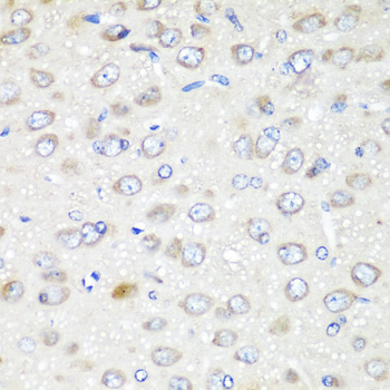 GABARAPL2 Rabbit Polyclonal Antibody