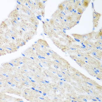 GABARAPL2 Rabbit Polyclonal Antibody