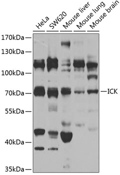 ICK Rabbit Polyclonal Antibody