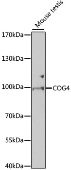 COG4 Rabbit Polyclonal Antibody