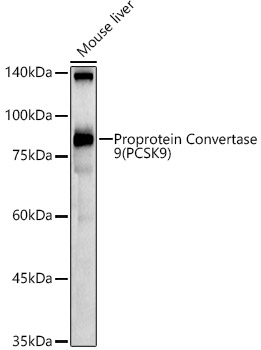 PCSK9 Rabbit Polyclonal Antibody