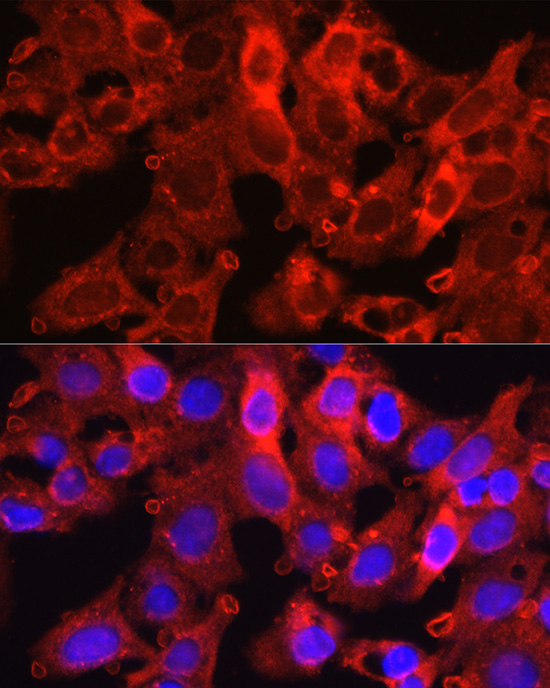PCSK9 Rabbit Polyclonal Antibody