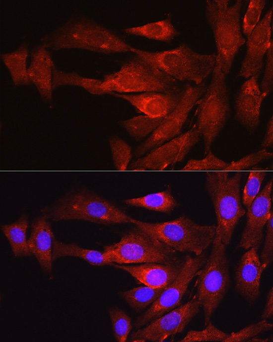PCSK9 Rabbit Polyclonal Antibody