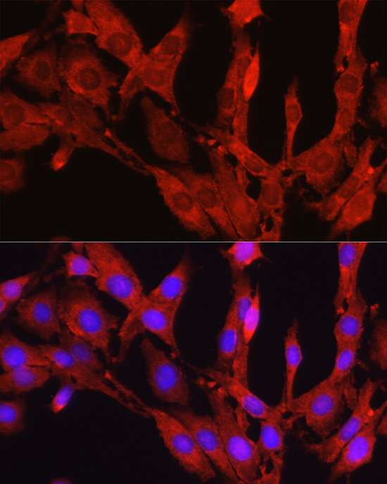 PCSK9 Rabbit Polyclonal Antibody