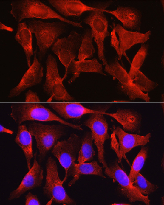 PCSK9 Rabbit Polyclonal Antibody