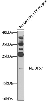 NDUFS7 Rabbit Polyclonal Antibody