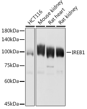 ACO1 Rabbit Polyclonal Antibody