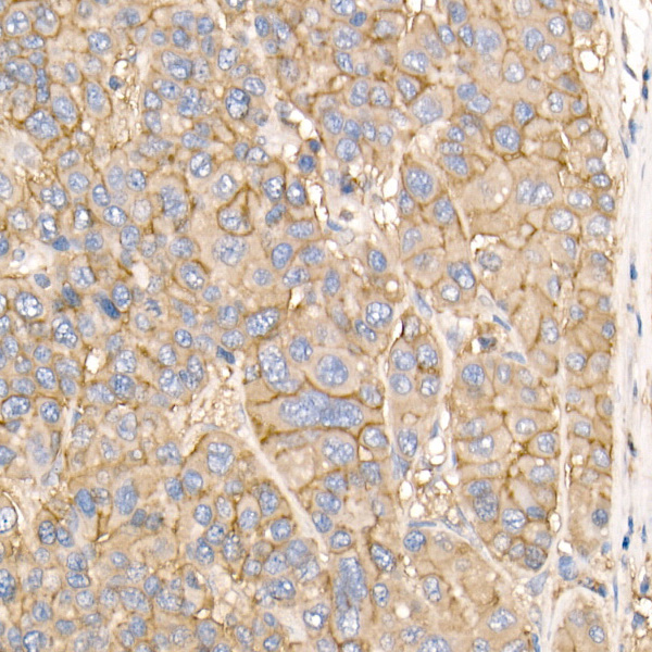 ATP1A1 Rabbit Polyclonal Antibody