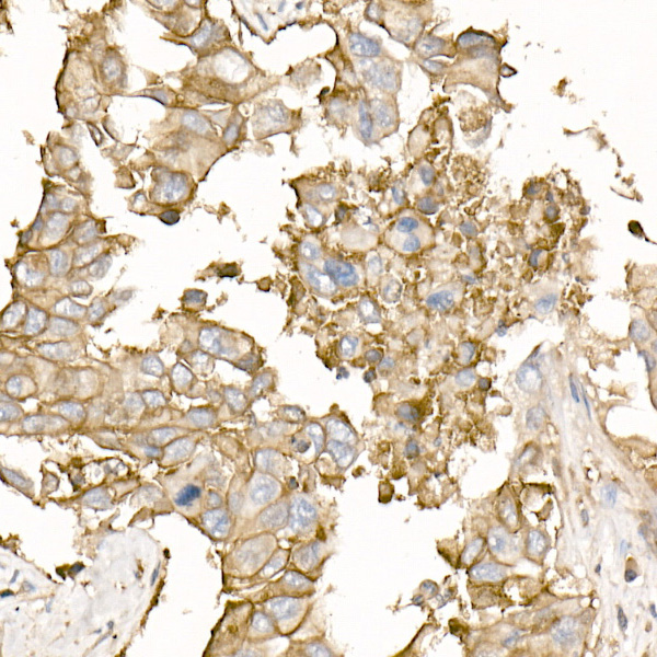 ATP1A1 Rabbit Polyclonal Antibody