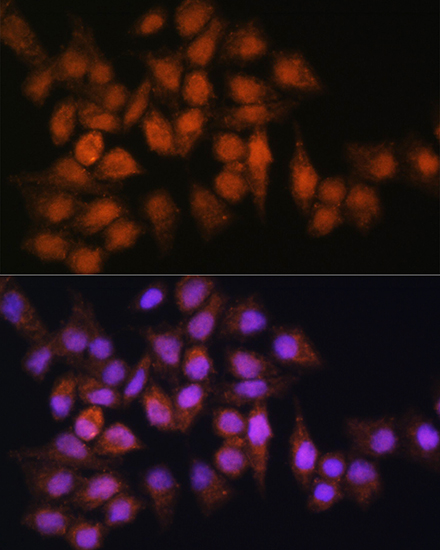 BPGM Rabbit Polyclonal Antibody