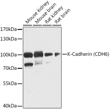 CDH6 Rabbit Polyclonal Antibody