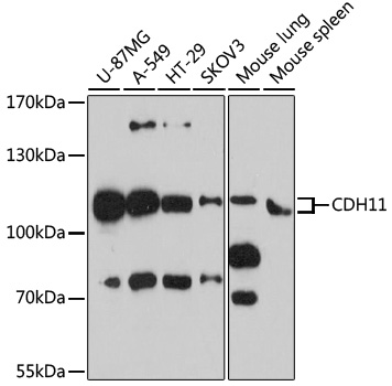 CDH11 Rabbit Polyclonal Antibody