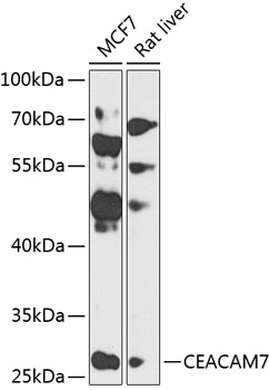 CEACAM7 Rabbit Polyclonal Antibody