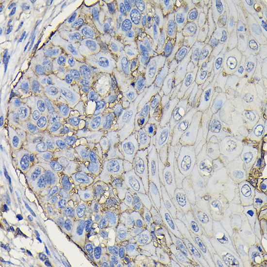 TACSTD2 Rabbit Polyclonal Antibody