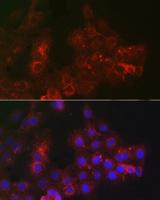 TACSTD2 Rabbit Polyclonal Antibody