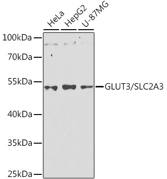GLUT3 Rabbit Polyclonal Antibody