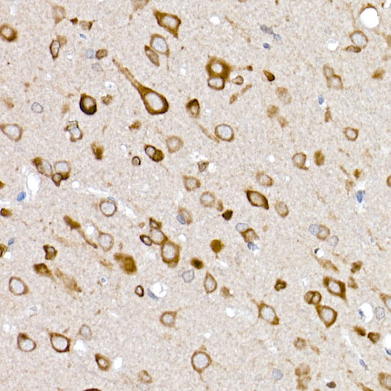 GLUT3 Rabbit Polyclonal Antibody