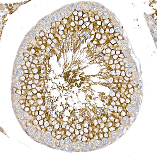 GLUT3 Rabbit Polyclonal Antibody