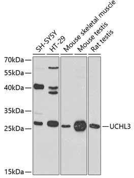 UCHL3 Rabbit Polyclonal Antibody