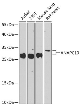 ANAPC10 Rabbit Polyclonal Antibody