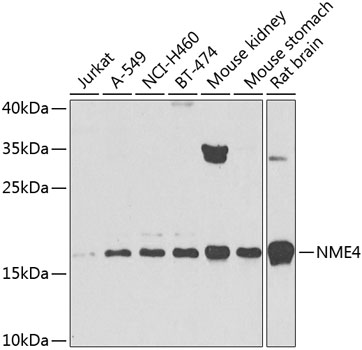 NME4 Rabbit Polyclonal Antibody