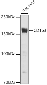 CD163 Rabbit Polyclonal Antibody