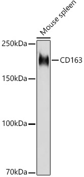 CD163 Rabbit Polyclonal Antibody