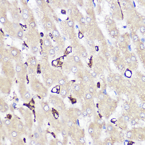 CD163 Rabbit Polyclonal Antibody