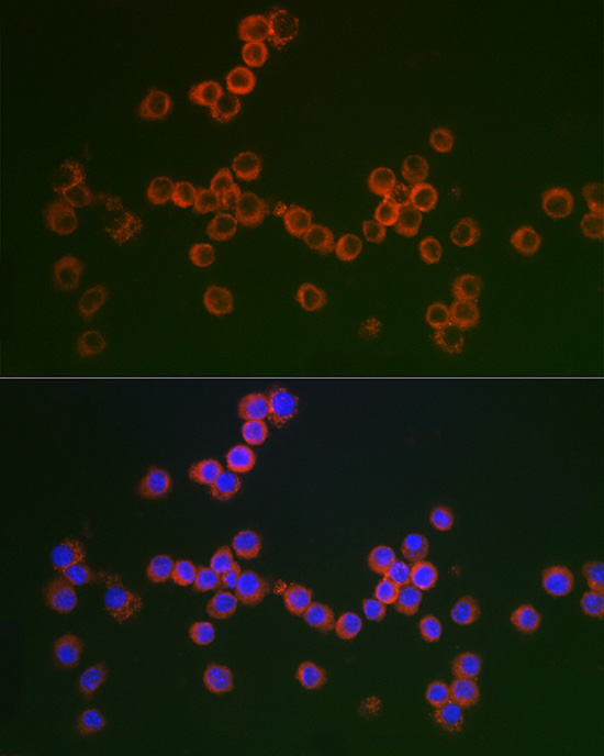 CD163 Rabbit Polyclonal Antibody