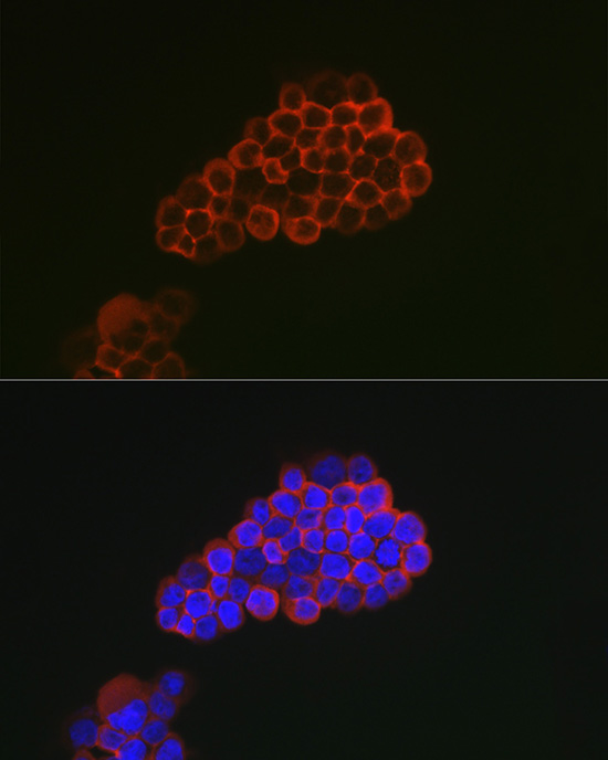CD163 Rabbit Polyclonal Antibody
