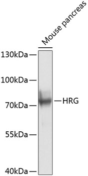 HRG Rabbit Polyclonal Antibody