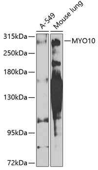 MYO10 Rabbit Polyclonal Antibody