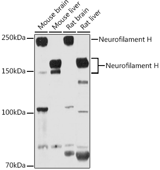 NEFH Rabbit Polyclonal Antibody