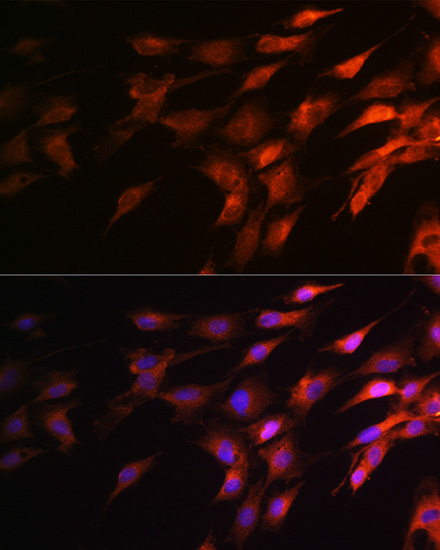 NEFH Rabbit Polyclonal Antibody