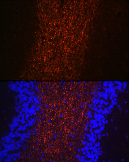 NEFH Rabbit Polyclonal Antibody