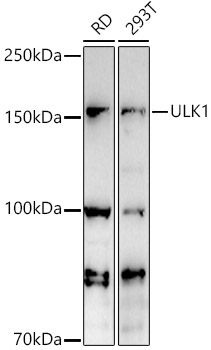ULk1 Rabbit Polyclonal Antibody