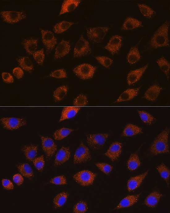 DLG1 Rabbit Polyclonal Antibody