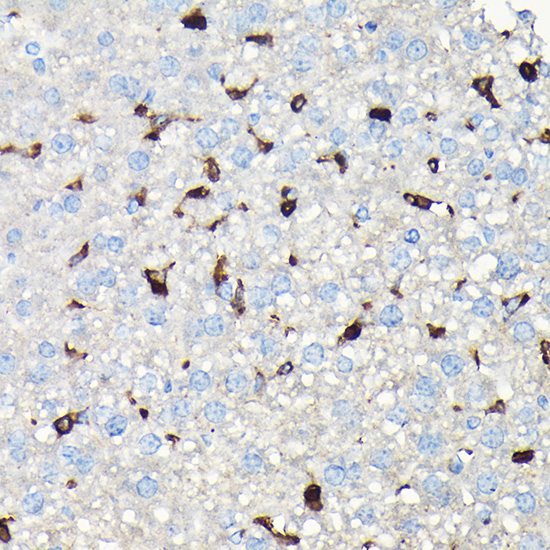 CORO1A Rabbit Polyclonal Antibody