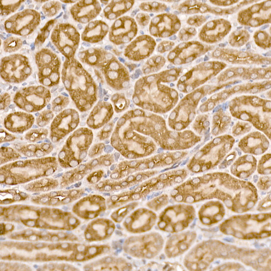 NUMB Rabbit Polyclonal Antibody