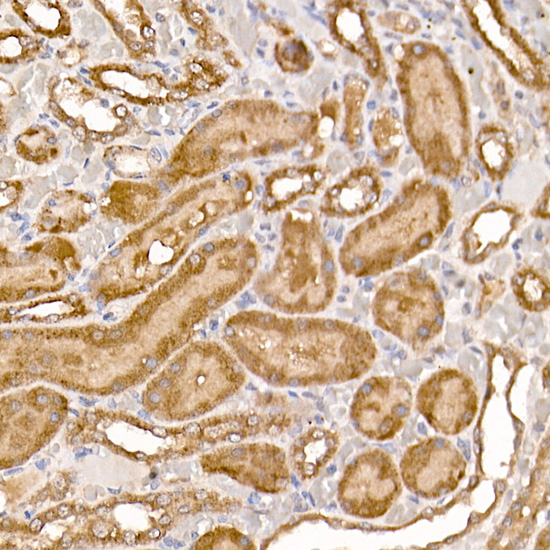 NUMB Rabbit Polyclonal Antibody