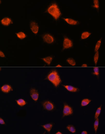 NUMB Rabbit Polyclonal Antibody
